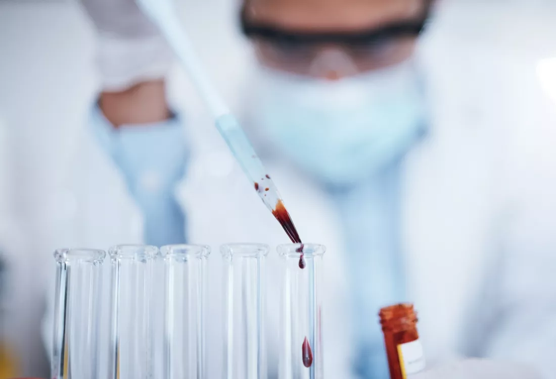 Una investigadora deja caer con una pipeta una muestra de sangre en un tubo de ensayo.